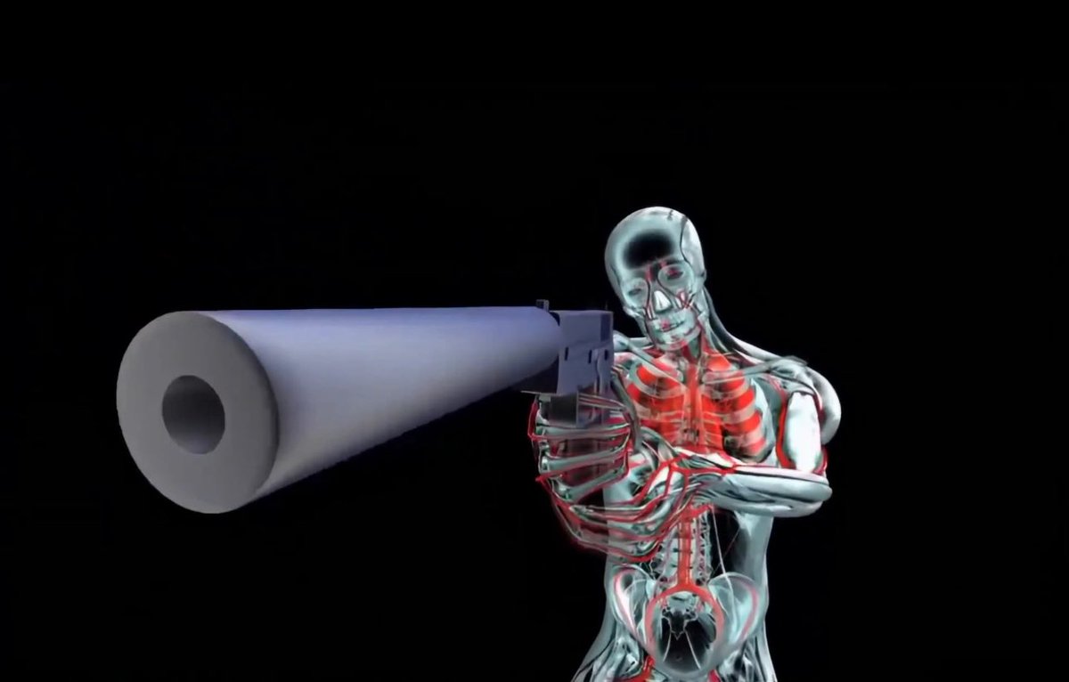 1000 Ways to Die S3 EP16