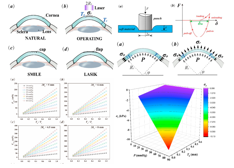 medntdj's tweet photo. Adhesion is safe to the refractive surgeries: A theoretical analysis https://t.co/cNeubGH6sQ… #Force loss #Ablated ratio #Interfacial adhesion #SMILE #LASIK #MedTwitter #scicomm #MedEd #AcademicTwitter https://t.co/WiaYgjtbjU
