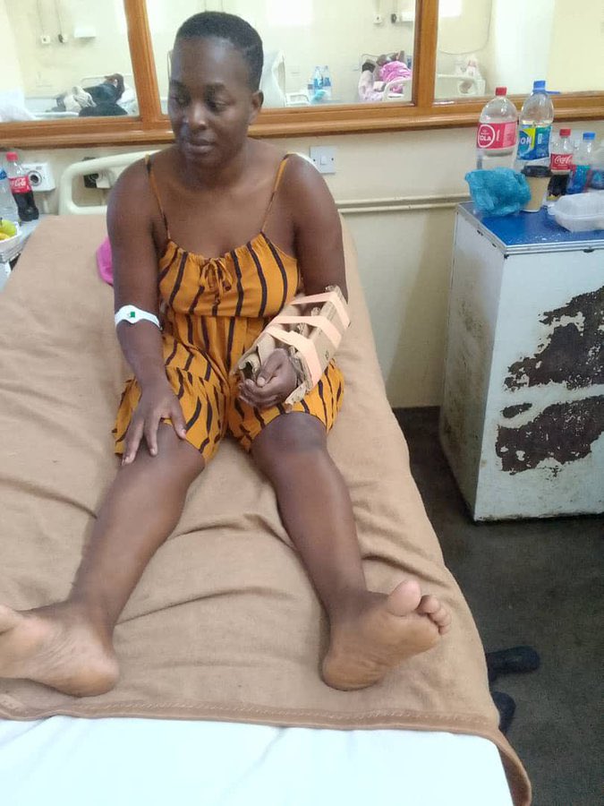 daddyhope's tweet photo. This woman was involved in an accident in Zimbabwe. 
She needed urgent medical care, including a cast, but the material was not available.

So, she was given a cardboard box with tape at a major hospital in Zimbabwe. 
This is the same country where the government has been paralysed because the president wants a third term.

All of Zimbabwe’s six central hospitals need only US$60 million a year to run smoothly without any shortages, but the money is looted by criminal cartels controlled by the president.

Today the hospitals struggle to get pain killers, thousands of Zimbabweans are dying daily unnecessarily from easily treatable diseases, tragic!