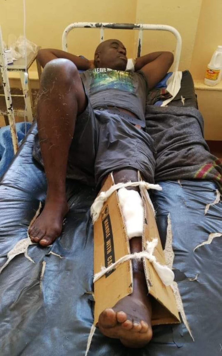 HopeWorks60's tweet image. 🔸What kind of public healthcare system is this? Why are cardboard boxes now being used to mend fractures? What are the bandages dirty and overused? Why are mattresses torn? Where is the bedding? This Govt’s incompetence stinks.

We need new leaders.🇿🇼