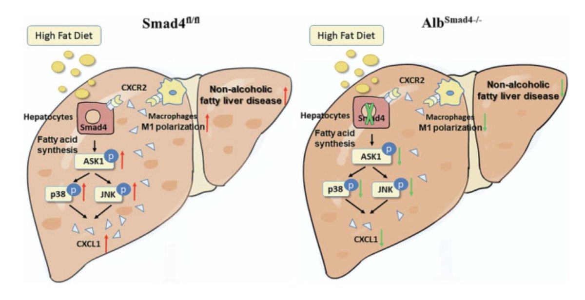 FanpuJi's tweet photo. 🔬 New discovery in #NAFLD research! 🔍

👉#Smad4 deficiency reduces liver fat accumulation
🛑Decreases #inflammatory cell infiltration 
🔄Suppresses ASK1/P38/JNK signaling pathway
🚫Inhibits #CXCL1 secretion
🎯A promising target for anti-NAFLD therapy🧬
https://t.co/bF2dqxOl52 https://t.co/ohWJuGeGqu