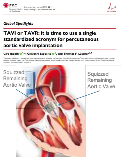 What it is the right expression: TAVI or TAVR? It is clearly TAVI = transcatheter aortic valve implantation, transcatheter aortic valve replacement is  the wrong word, the native valve remains, is not replaced as in SAVR, it is squeezed between the  valve and the aortic wall.