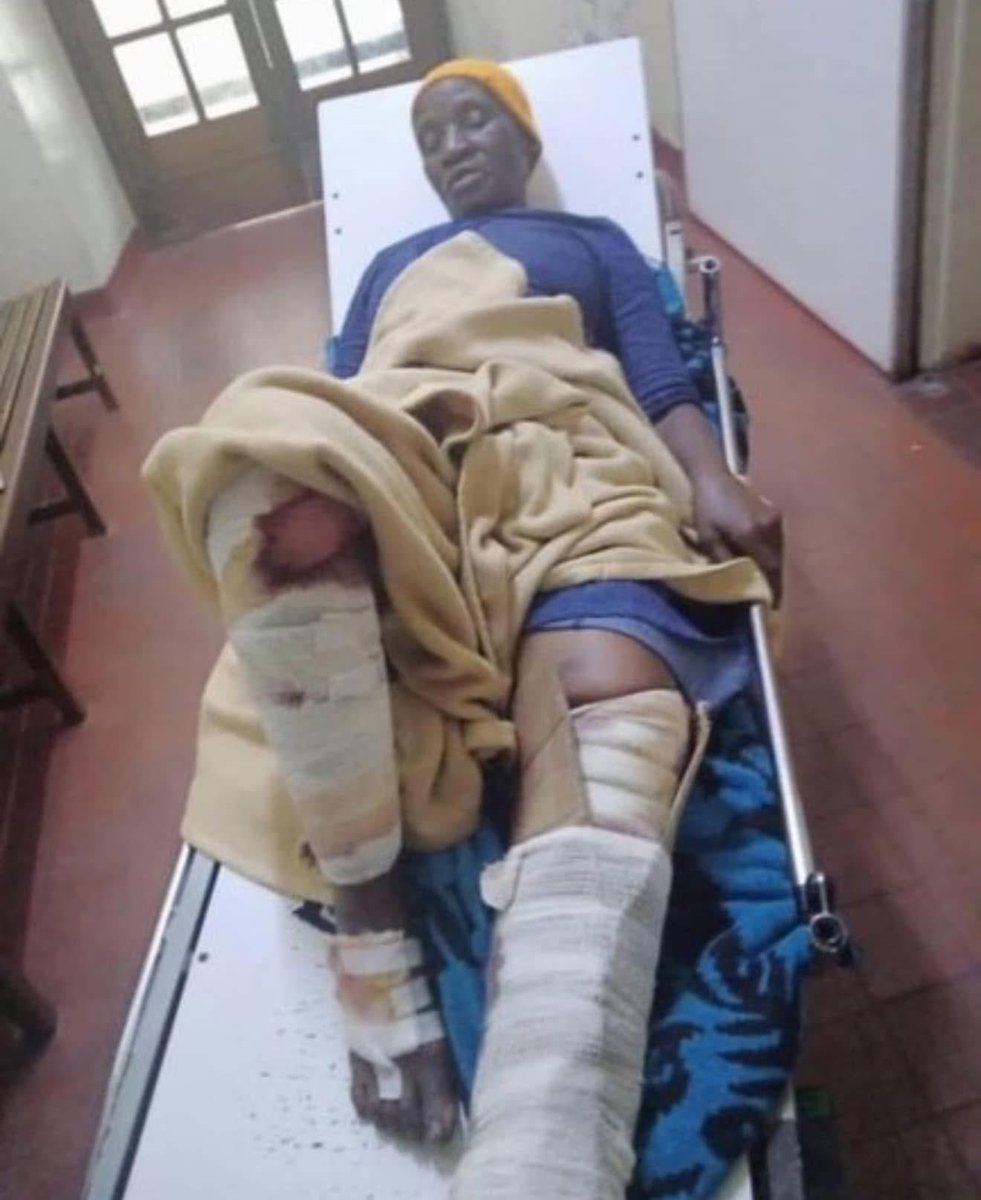 HopeWorks60's tweet image. 🔸We are not letting this healthcare issue go. Why is the practice of using makeshift cardboard boxes to treat fractures so widespread in our public hospitals? Where is the dignity? Surely, you must all resign. This level of incompetence borders on the criminal. It’s a mess.

We…