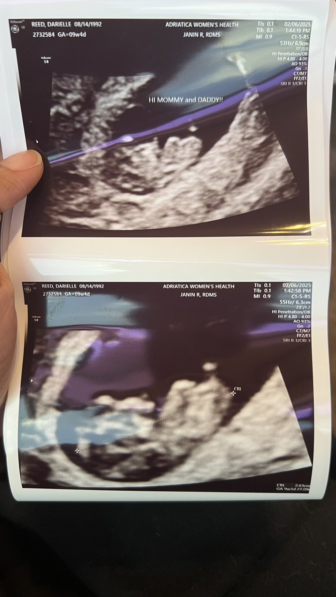 wthDARIELLE's tweet image. My biggest reveal yet 🍼✨

SEPTEMBER 2025

A star will be born 💕🪭🤰🏾