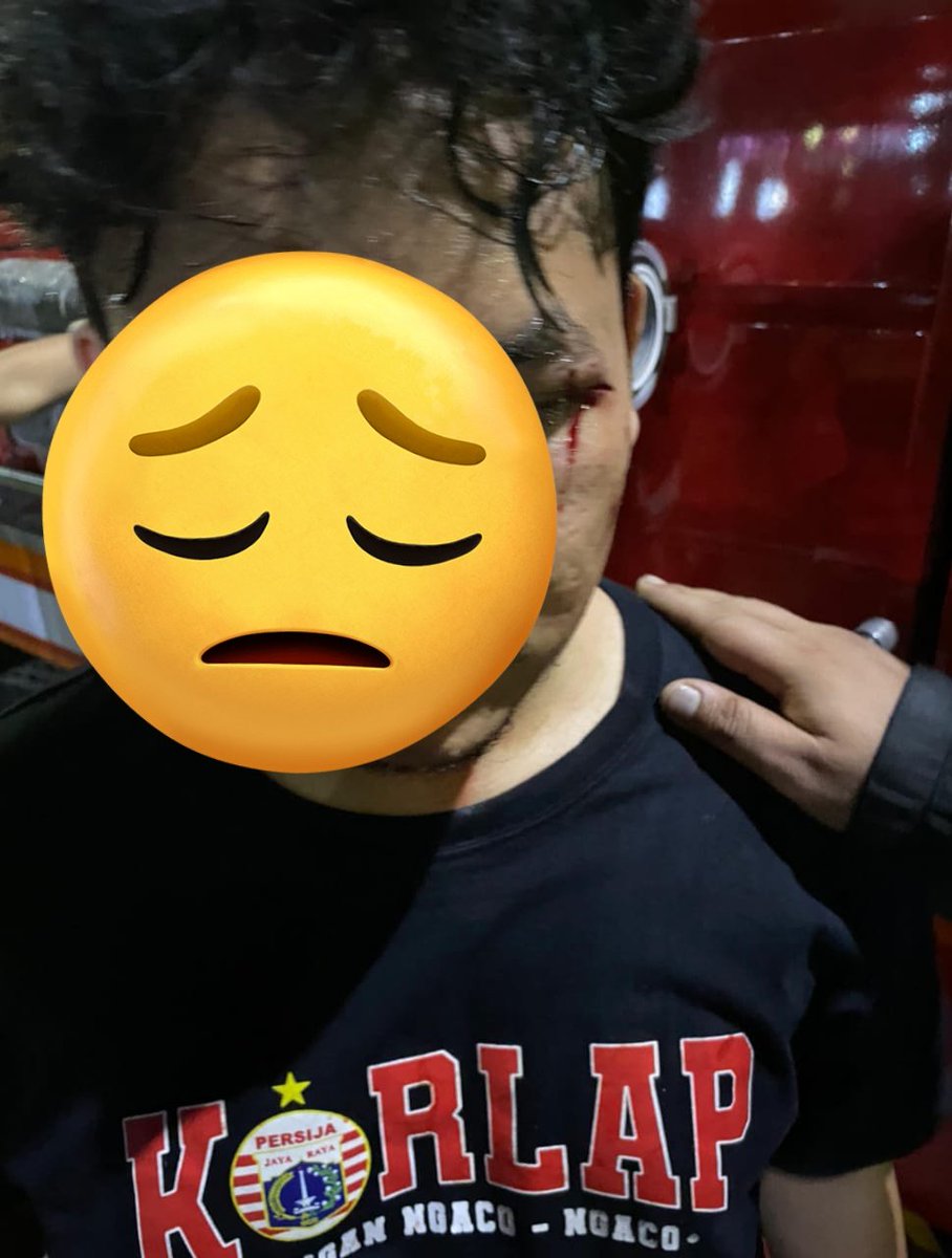 Dulu anak the jak paling takut sama korlap. Jaman sekarang korlap jg disikat. Ngotak dikitlah tolol!!! Mereka sukarelawan dtng paling awal pulang paling akhir cuma jalanin tgs dr pengurus pusat biar lo semua aman &amp; nyaman di stadion