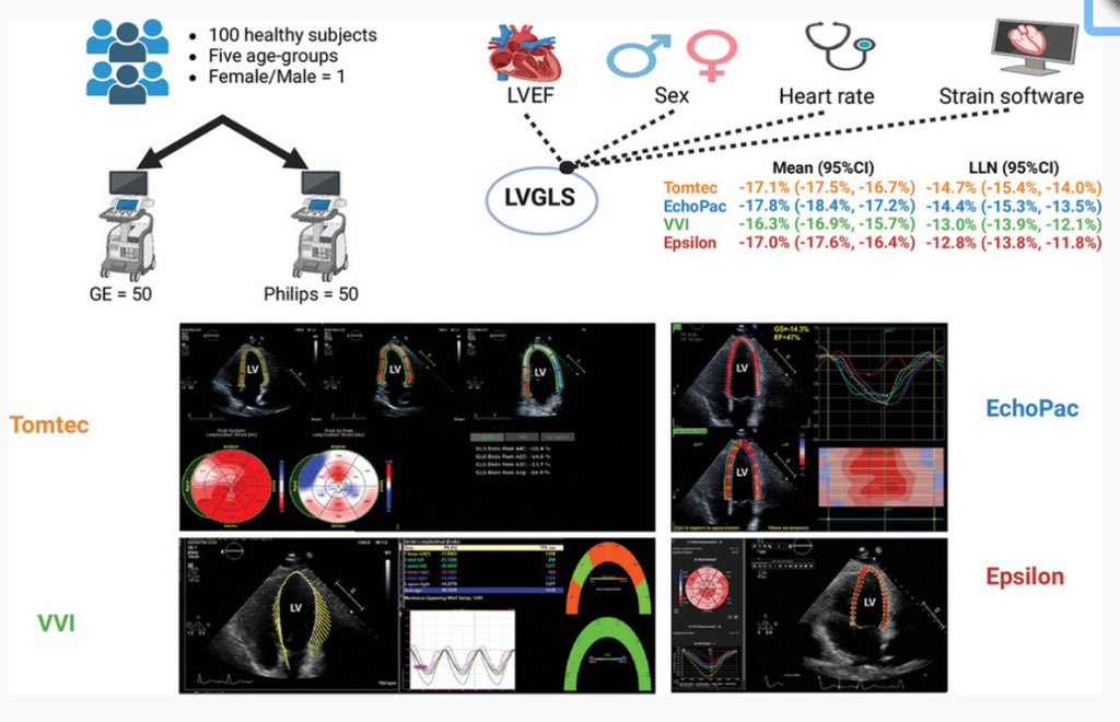 Ankit Agrawal (@ankitagrawalmd) on Twitter photo Pleased to share our work on reference ranges of LV Global Longitudinal Strain published in Echocardiography
<a href="/TomKMWang/">Tom Wang MBChB MD</a> <a href="/TiffanyDong6/">Tiffany Dong</a> <a href="/JeldahdahMD/">Joseph El Dahdah</a> <a href="/ElioHarounMD/">Elio Haroun</a> <a href="/DocMajid/">Muhammad Majid</a> <a href="/S_Sorathia1/">Sharmeen Sorathia</a> <a href="/ASE360/">American Society of Echocardiography</a>
onlinelibrary.wiley.com/doi/full/10.11… Pleased to share our work on reference ranges of LV Global Longitudinal Strain published in Echocardiography
<a href="/TomKMWang/">Tom Wang MBChB MD</a> <a href="/TiffanyDong6/">Tiffany Dong</a> <a href="/JeldahdahMD/">Joseph El Dahdah</a> <a href="/ElioHarounMD/">Elio Haroun</a> <a href="/DocMajid/">Muhammad Majid</a> <a href="/S_Sorathia1/">Sharmeen Sorathia</a> <a href="/ASE360/">American Society of Echocardiography</a>
onlinelibrary.wiley.com/doi/full/10.11…