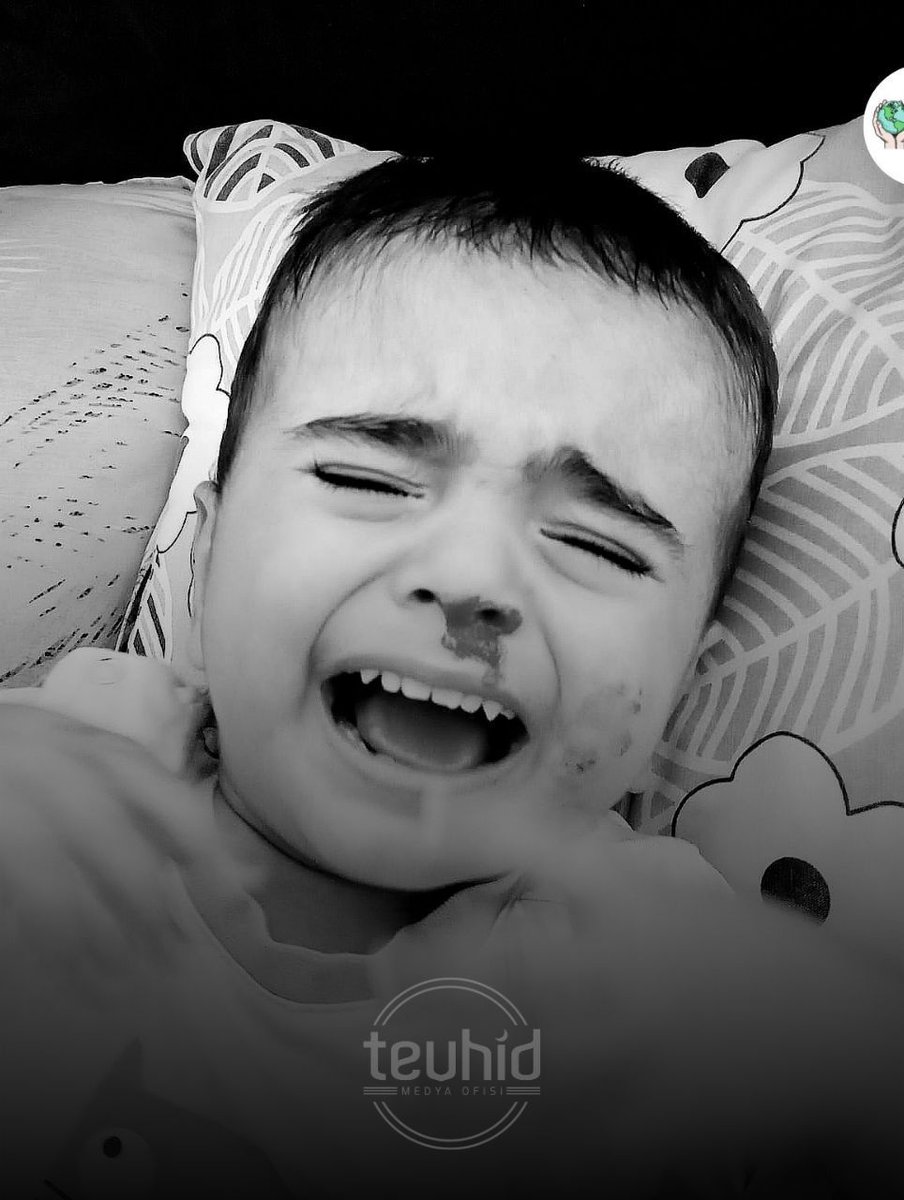 Minik Azer kardeşimizin sizin desteğinize ihtiyacı var.

#SONGÜN