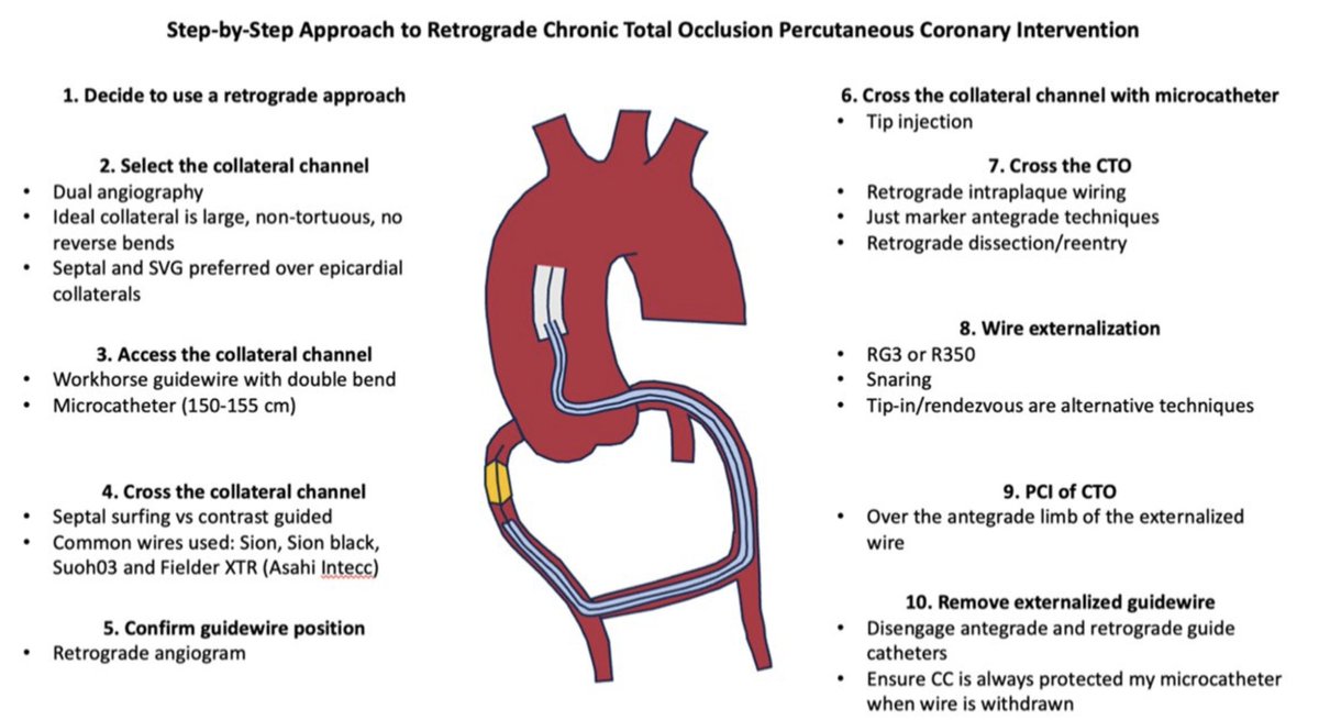Salman Allana, MD FACC FSCAI (@allanasalman) on Twitter photo Now online <a href="/PCVDJournal/">Progress in Cardiovascular Diseases</a>
For CTO enthusiasts: Retrograde CTO PCI technique, outcomes and safety optimization
Link:sciencedirect.com/science/articl…
<a href="/AmitGoyalMD/">Amit Goyal MD MAS</a> <a href="/SarasVallabhMD/">Saraschandra Vallabhajosyula, MD MSc</a> <a href="/esbrilakis/">Emmanouil Brilakis</a> <a href="/UTSWMedCenter/">UT Southwestern Medical Center</a> #CTO #CardioTwitter Now online <a href="/PCVDJournal/">Progress in Cardiovascular Diseases</a>
For CTO enthusiasts: Retrograde CTO PCI technique, outcomes and safety optimization
Link:sciencedirect.com/science/articl…
<a href="/AmitGoyalMD/">Amit Goyal MD MAS</a> <a href="/SarasVallabhMD/">Saraschandra Vallabhajosyula, MD MSc</a> <a href="/esbrilakis/">Emmanouil Brilakis</a> <a href="/UTSWMedCenter/">UT Southwestern Medical Center</a> #CTO #CardioTwitter