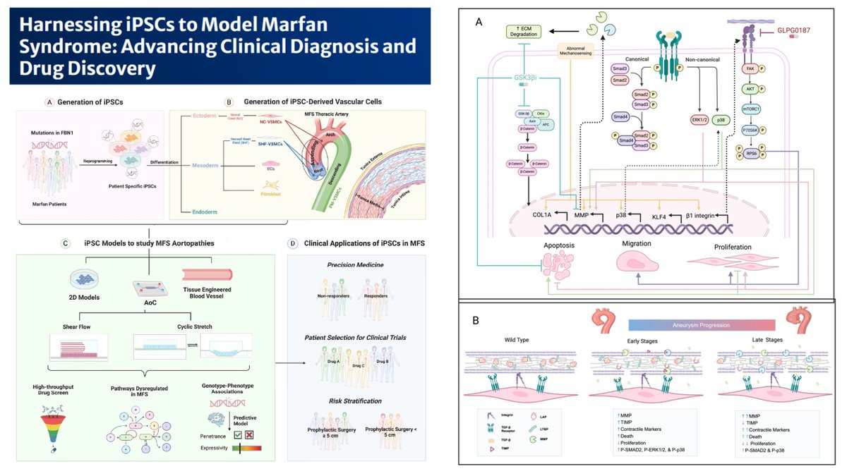 Hao Yin (@haoyin20) on Twitter photo Thank <a href="/mjkchandy/">Mark Chandy</a> for including me in this productive review-writing project👇
Harnessing iPSCs to Model Marfan Syndrome: Advancing Clinical Diagnosis and Drug Discovery
Guess which parts were written by me?😁
#CurrTreatOptionsCardiovascMed 2025
link.springer.com/article/10.100… Thank <a href="/mjkchandy/">Mark Chandy</a> for including me in this productive review-writing project👇
Harnessing iPSCs to Model Marfan Syndrome: Advancing Clinical Diagnosis and Drug Discovery
Guess which parts were written by me?😁
#CurrTreatOptionsCardiovascMed 2025
link.springer.com/article/10.100…