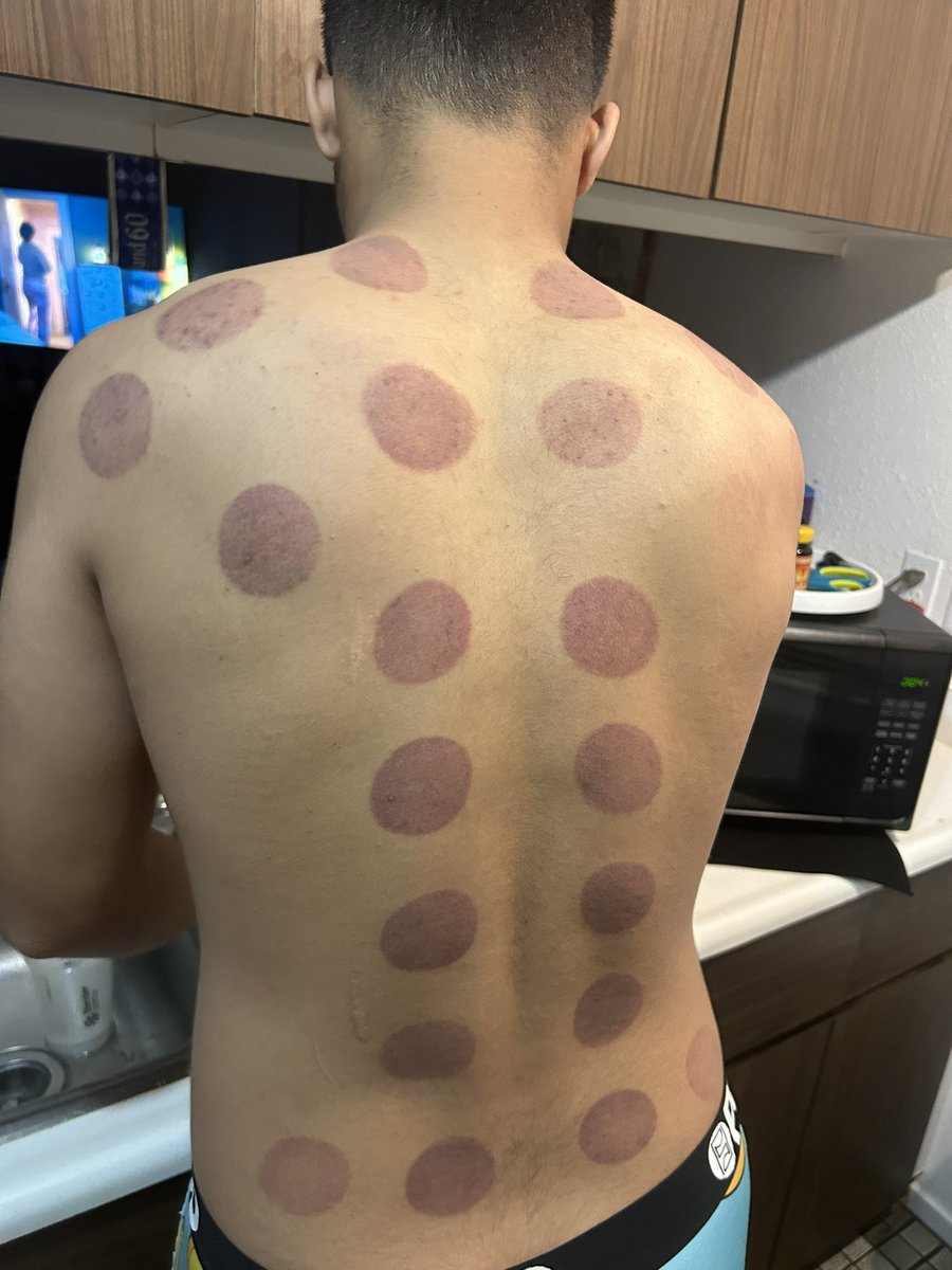 Mahalo <a href="/BodyFixHI/">Body Fix</a> for helping the recovery process🤙🏼