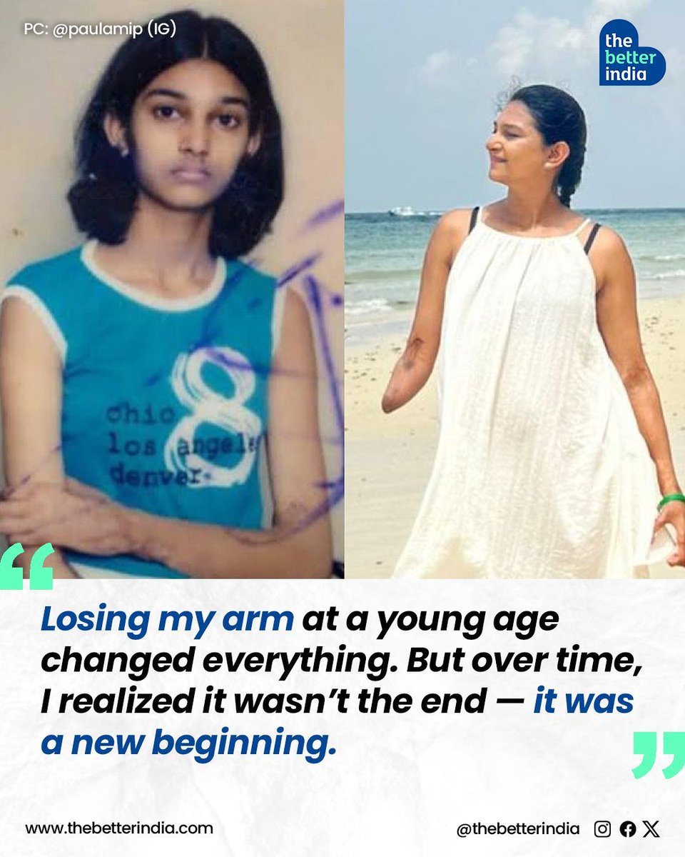 thebetterindia's tweet photo. At 12, Paulami Patel’s life changed in an instant. While playing, she was electrocuted by 11,000 volts—an accident that resulted in the loss of her right hand.

Everyday tasks, from zipping a bag to writing exams, became challenges she had to overcome. And she did.

@PaulamiPatel 

#AgainstAllOdds #UnbreakableSpirit #Inspiration #Resilience #NeverGiveUp #StrongerThanEver #Motivation