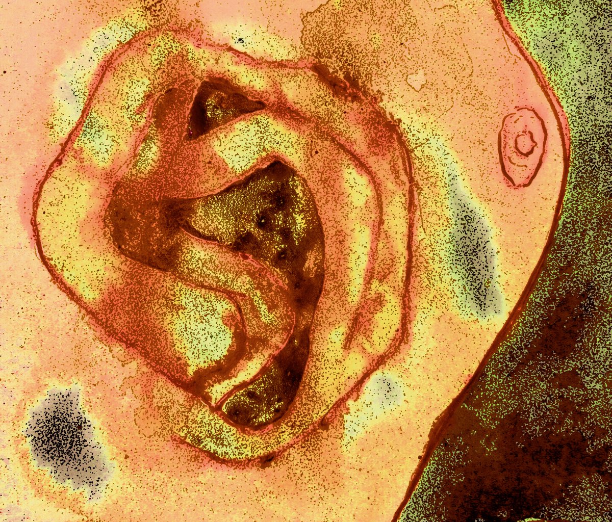 AFYA2526: Deal with bifurcation, split your work into two parts. fineartdrawinglca.blogspot.com/2025/02/drawin…