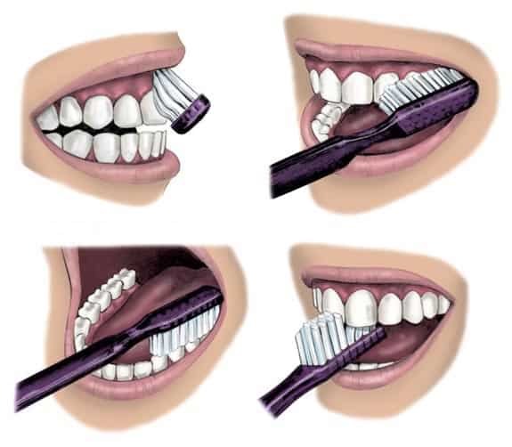 Patrick39268146's tweet photo. A clean mouth is a happy mouth! Maintain good oral hygiene and schedule screenings to catch dental problems and oral cancer early. 🦷❤️#HealthyTeeth #OralCare #DentalHealth #OralCancerPrevention #ScreeningSavesLives #CleanMouthHealthyLife #BrushAndFloss https://t.co/E7tspUDNrg