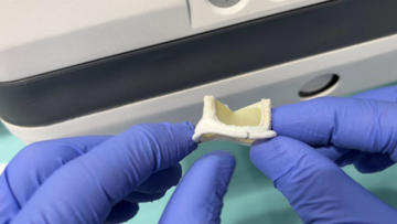 TAV-in-SAV for surgical bioprosthetic valve failure

📺pcronline.com/Cases-resource… 

Watch the replay of this session to get the key information needed to  evaluate a failed surgical bioprosthesis before considering a  valve-in-valve intervention.

Learn strategies to avoid  high