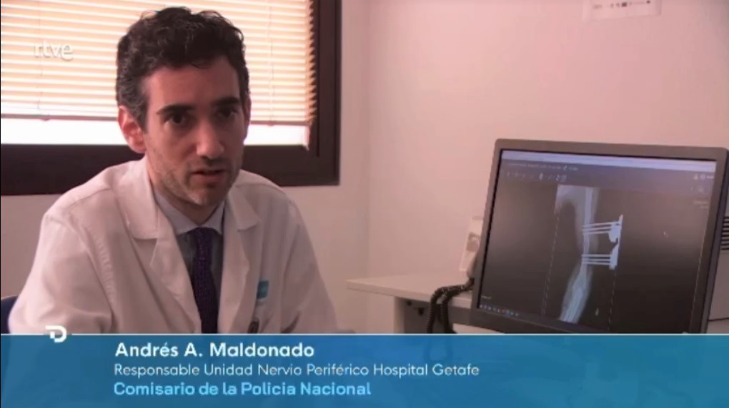 Javier Gómez García (@fcojaviergomez) on Twitter photo Enhorabuena a <a href="/drAAmaldonado/">Andres A. Maldonado</a> y Equipo de la Unidad de Nervio Periférico y Plexo Braquial #HospitaldeGetafe por su éxito en la recuperación de Fco.Javier González <a href="/policia/">Policía Nacional</a> tras su accidente vía <a href="/telediario_tve/">Telediarios de TVE</a> #ReferenteSNS <a href="/SECPREorg/">SECPRE</a> 💻rtve.es/noticias/20250……
Mostrar más Enhorabuena a <a href="/drAAmaldonado/">Andres A. Maldonado</a> y Equipo de la Unidad de Nervio Periférico y Plexo Braquial #HospitaldeGetafe por su éxito en la recuperación de Fco.Javier González <a href="/policia/">Policía Nacional</a> tras su accidente vía <a href="/telediario_tve/">Telediarios de TVE</a> #ReferenteSNS <a href="/SECPREorg/">SECPRE</a> 💻rtve.es/noticias/20250……
Mostrar más