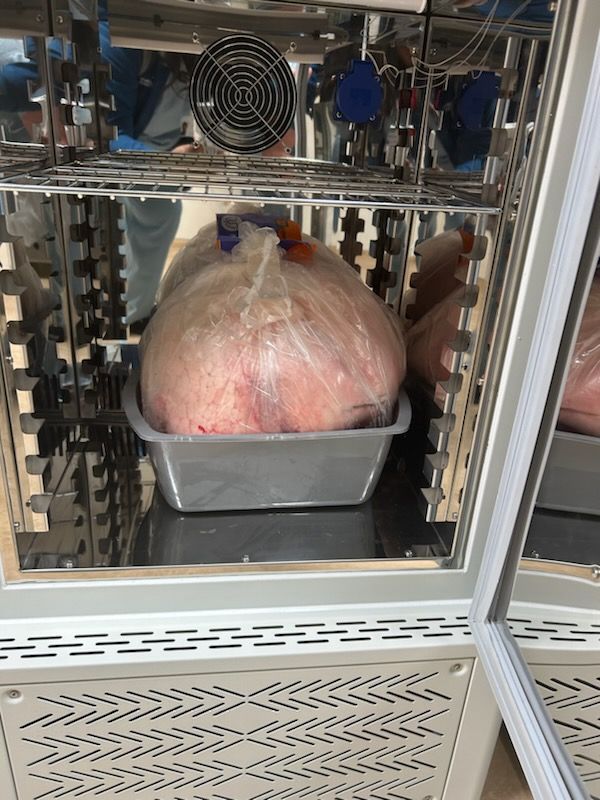 By combining cutting-edge technologies such as “lungs in a box” and “lungs in a fridge,” <a href="/NorthwesternMed/">Northwestern Medicine</a>'s <a href="/NM_Lung/">NM Pulmonary and Thoracic Surgery</a> was able to widen the donor pool and shorten the wait time for 🫁 patients, including those with advanced-stage #cancers.

PRESS RELEASE: buff.ly/3CEbaa1