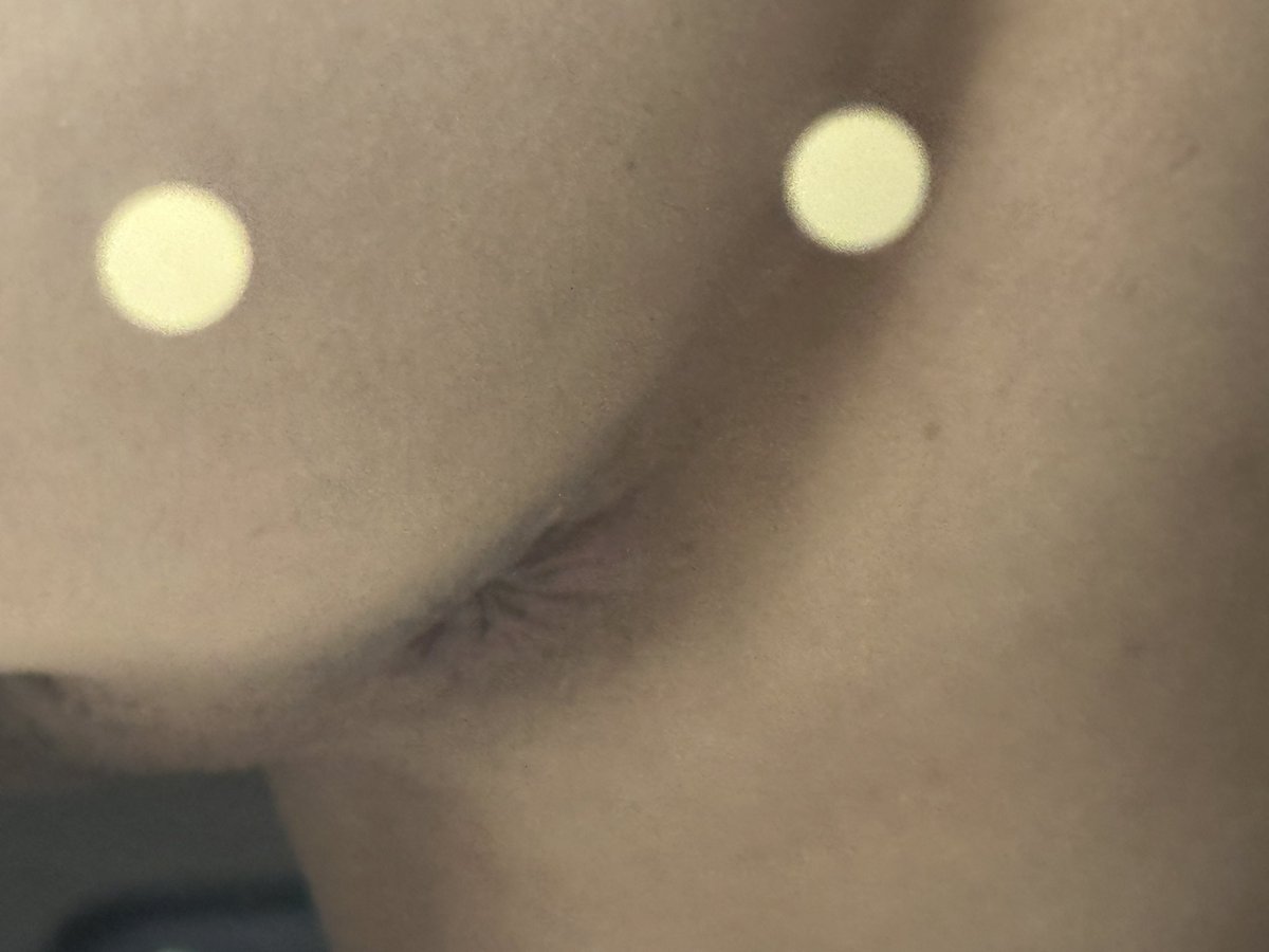 脱毛了 变无毛逼了