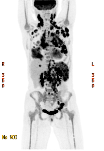 Mehdi Hamadani, MD tweet media