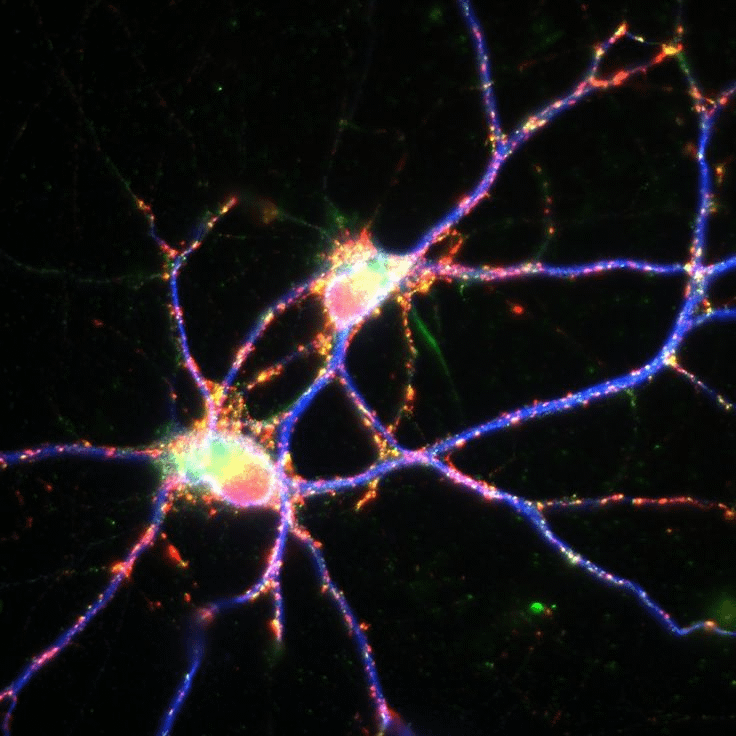 brianmaierhofer's tweet photo. Depression and anxiety aren’t life sentences—they’re symptoms of a deeper imbalance.

Mainstream fixes like talk therapy only scratch the surface. But with neuroscience, permanent healing is possible.

Here’s what depression really is—and how to reverse it naturally: 🧵 https://t.co/X6ku86JvNW