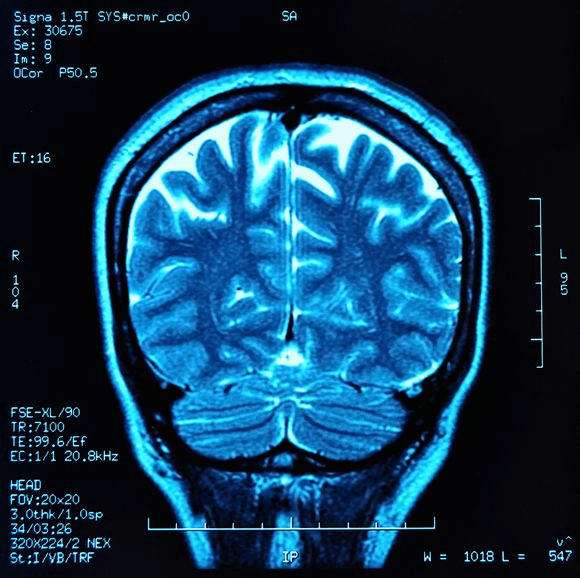 brianmaierhofer's tweet photo. Depression and anxiety aren’t life sentences—they’re symptoms of a deeper imbalance.

Mainstream fixes like talk therapy only scratch the surface. But with neuroscience, permanent healing is possible.

Here’s what depression really is—and how to reverse it naturally: 🧵 https://t.co/X6ku86JvNW