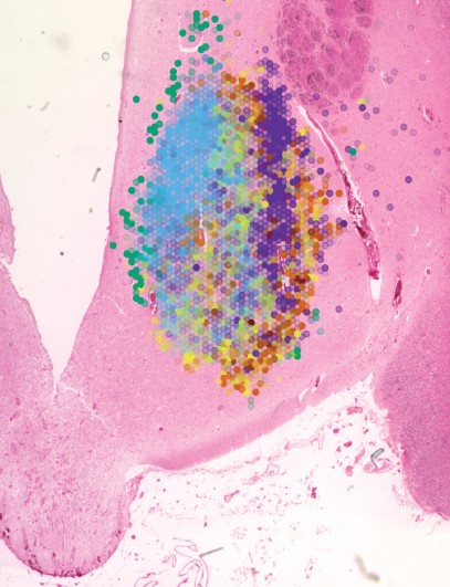 HYPOMAP: A breakthrough in understanding metabolic health by researchers <a href="/IMS_MRL/">Inst Metabolic Science-Metabolic Research Labs</a> and <a href="/MPI_Metabolism/">Max Planck Institute for Metabolism Research</a>, providing an unparalleled view of the brain’s appetite centre &amp; helping to accelerate development of therapies for obesity and diabetes. <a href="/Nature/">nature</a> mrl.ims.cam.ac.uk/news/mapping-h…