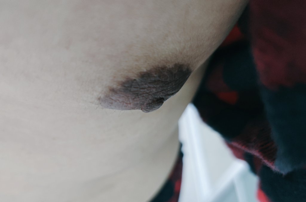 我就想问一下，有没有女孩子谁像我一样，奶子还长毛毛的😂