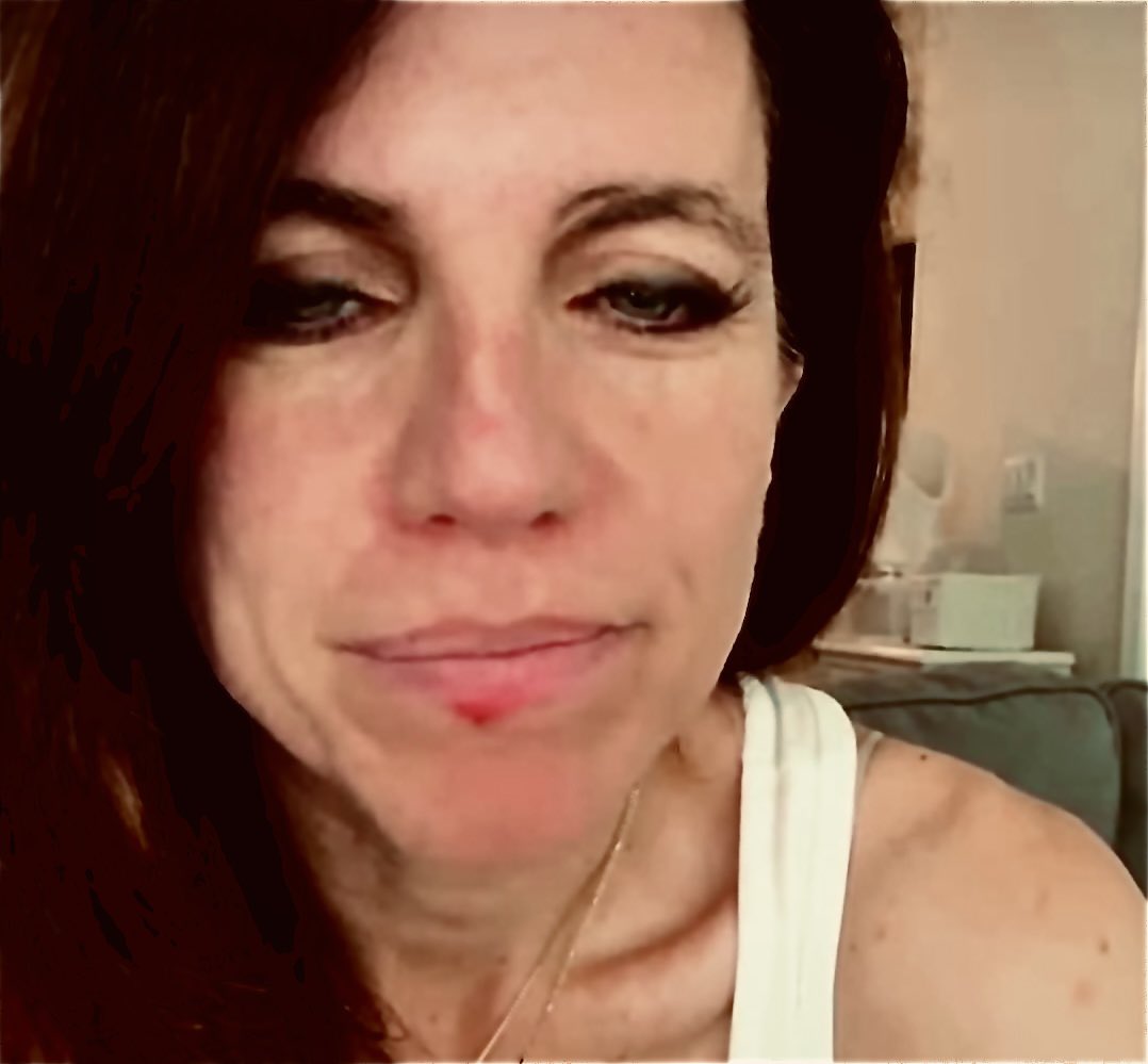 MrGlenCarroll's tweet photo. @RepNancyMace By the way, how are you feeling? It appears your herpes are flaring up again? #Herpes #CitadelDEI #BadBoobJob #FakeRapeStory #DaddyGotMeIn #DollarStoreBarbie. https://t.co/42ftc1FXSm