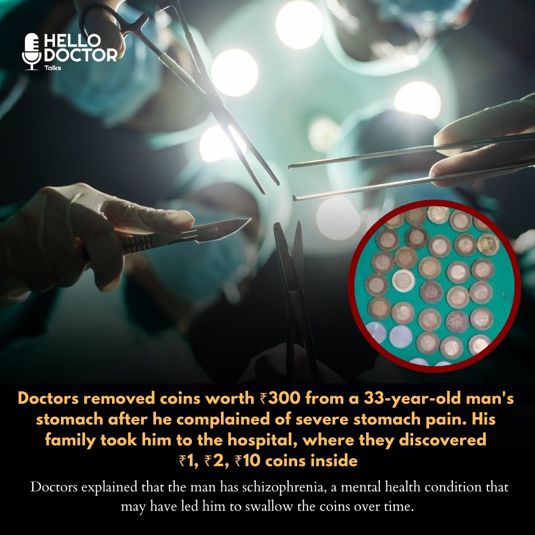 HelloDoctortalk's tweet photo. Doctors in Bilaspur, Himachal Pradesh, removed coins worth ₹300 from a 33-year-old man's stomach. His family took him to the hospital after he complained of stomach pain. The coins included ₹1, ₹2, ₹10. denominations.  
#MedTwitter  #Medx #Surgery https://t.co/nVy0lawfve