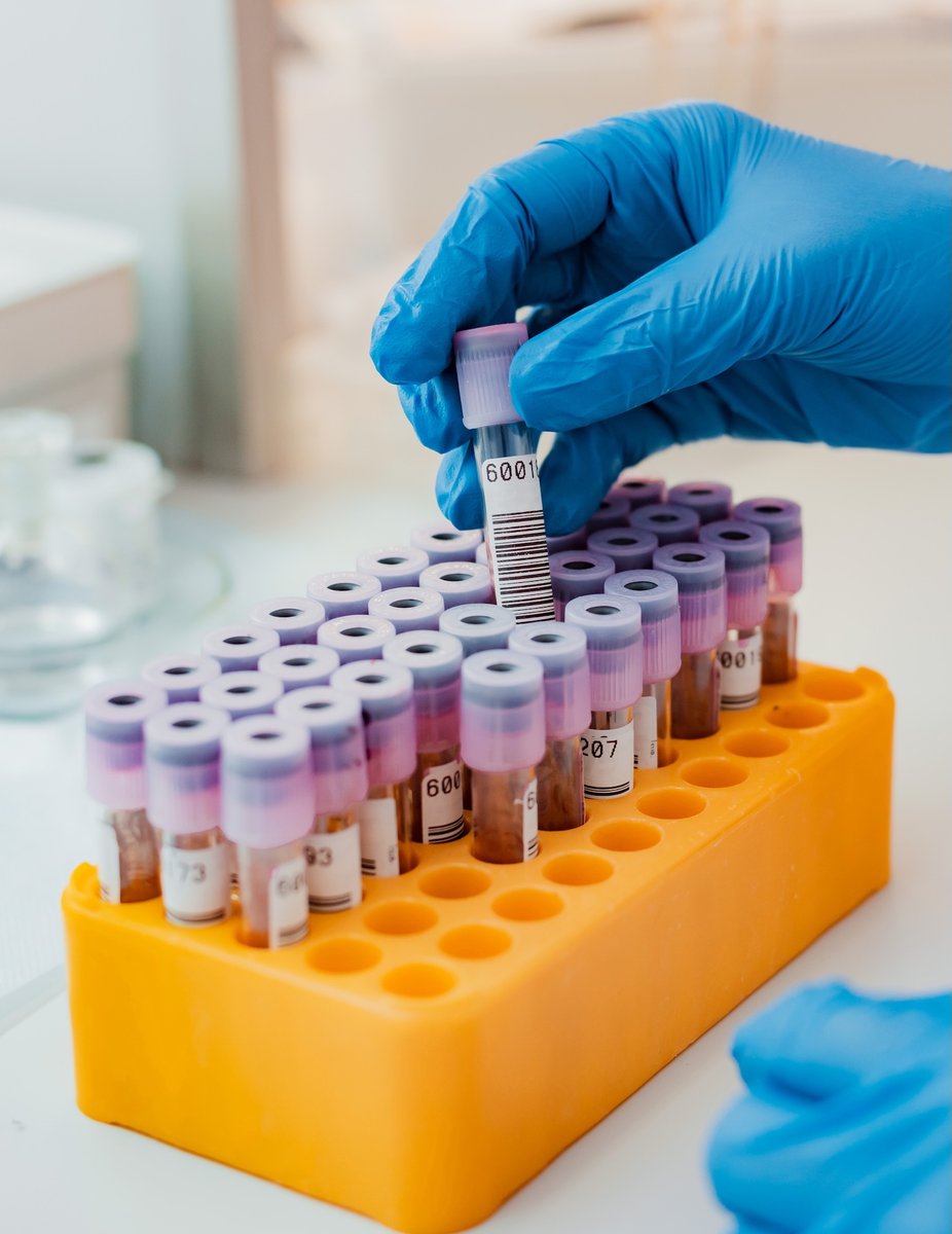 Stanford Medicine (@stanfordmed) on Twitter photo Stanford Medicine is the first to offer the new blood test for mold infections deep inside the body, sparing patients from tissue biopsies. stan.md/40NFl6y
<a href="/StanfordHealth/">Stanford Health Care</a> Stanford Medicine is the first to offer the new blood test for mold infections deep inside the body, sparing patients from tissue biopsies. stan.md/40NFl6y
<a href="/StanfordHealth/">Stanford Health Care</a>