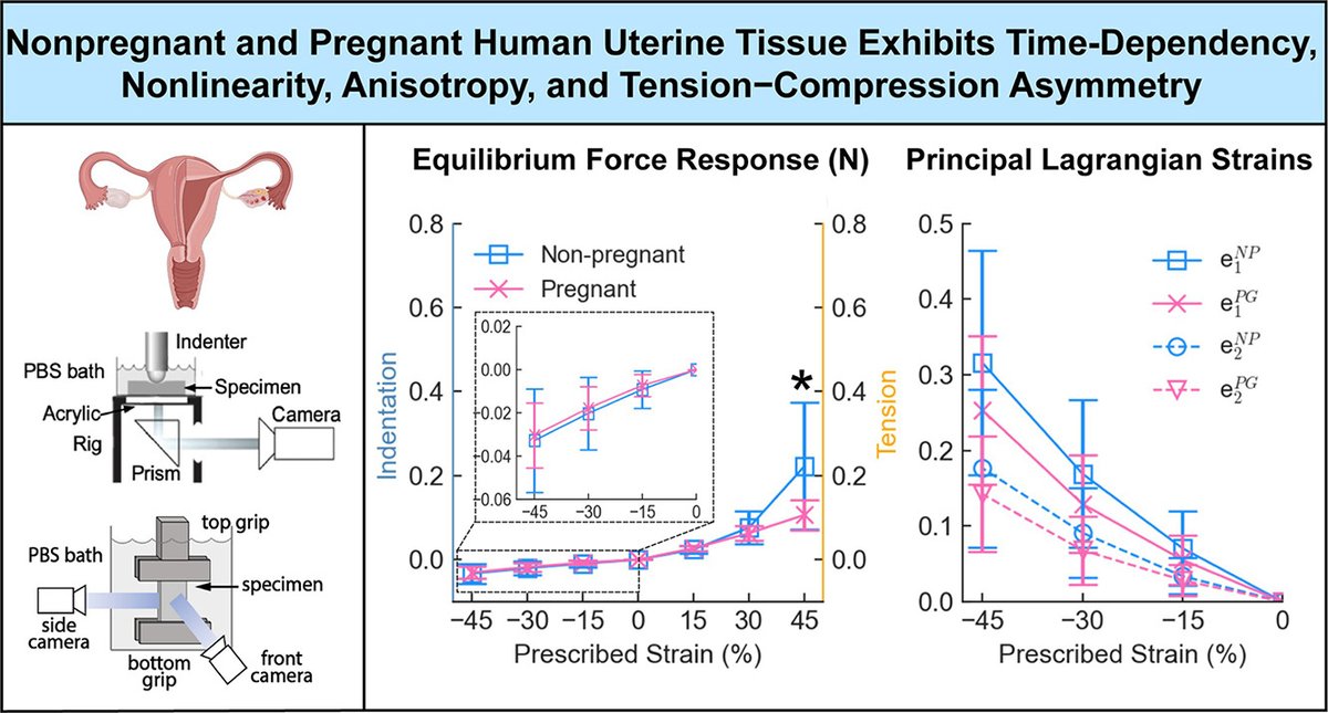 Acta Biomaterialia (@actabio) on Twitter photo Professor Kristin Myers: Equilibrium mechanical properties of the human uterus in tension and compression <a href="/kmyerslab/">Kristin Myers</a> <a href="/MechCU/">CU MechEngineering</a> <a href="/ColumbiaBME/">Columbia BME</a> <a href="/KSUEngineering/">KSU Engineering</a> <a href="/ColumbiaPath/">Columbia Pathology</a> <a href="/ColumbiaOBGYN/">Columbia Women's Health</a> <a href="/EE_ColumbiaSEAS/">Columbia | EE</a> <a href="/uhmedjabsom/">John A. Burns School of Medicine</a> sciencedirect.com/science/articl… Professor Kristin Myers: Equilibrium mechanical properties of the human uterus in tension and compression <a href="/kmyerslab/">Kristin Myers</a> <a href="/MechCU/">CU MechEngineering</a> <a href="/ColumbiaBME/">Columbia BME</a> <a href="/KSUEngineering/">KSU Engineering</a> <a href="/ColumbiaPath/">Columbia Pathology</a> <a href="/ColumbiaOBGYN/">Columbia Women's Health</a> <a href="/EE_ColumbiaSEAS/">Columbia | EE</a> <a href="/uhmedjabsom/">John A. Burns School of Medicine</a> sciencedirect.com/science/articl…