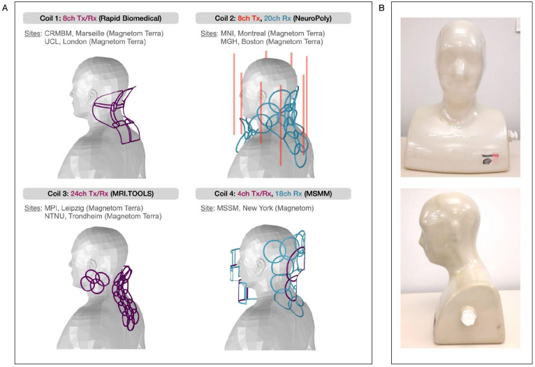 Julien Cohen-Adad (@jcohenadad) on Twitter photo Are you interested in imaging the spinal cord at 7T? Not sure what coil to use? Check out this recent work led by <a href="/EvaAlonsoOrtiz/">Eva Alonso-Ortiz</a> and collaborators where we compare different coil designs: pubmed.ncbi.nlm.nih.gov/39868333/ Are you interested in imaging the spinal cord at 7T? Not sure what coil to use? Check out this recent work led by <a href="/EvaAlonsoOrtiz/">Eva Alonso-Ortiz</a> and collaborators where we compare different coil designs: pubmed.ncbi.nlm.nih.gov/39868333/