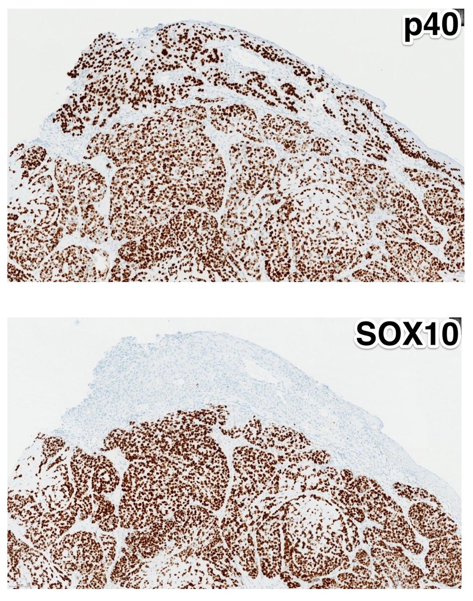 Tim Bracey tweet media