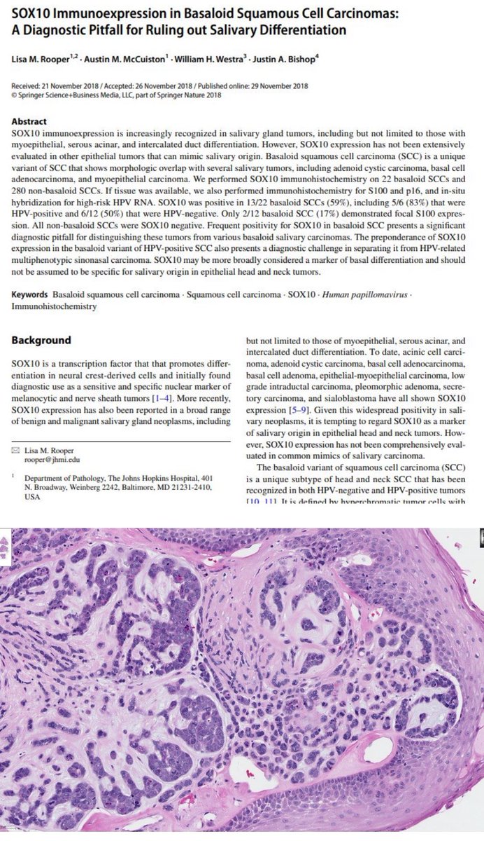 Tim Bracey tweet media