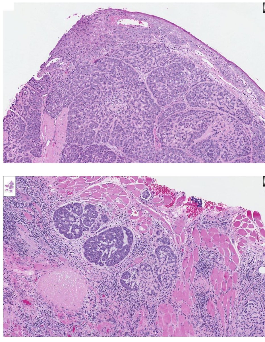 Tim Bracey tweet media