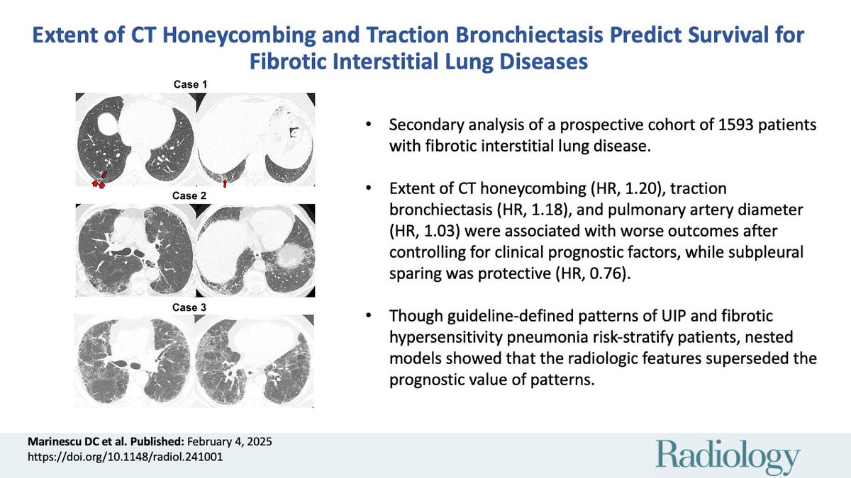 @RadiologyEditor (@radiologyeditor) on Twitter photo The extent of fibrosis, measured by honeycombing and traction bronchiectasis, was a consistent predictor of death or lung transplant in all interstitial lung disease subtypes. A dose-dependent association! 🫁 <a href="/marinescudc/">Daniel Marinescu</a> #LungDisease #Radiology
pubs.rsna.org/doi/10.1148/ra… The extent of fibrosis, measured by honeycombing and traction bronchiectasis, was a consistent predictor of death or lung transplant in all interstitial lung disease subtypes. A dose-dependent association! 🫁 <a href="/marinescudc/">Daniel Marinescu</a> #LungDisease #Radiology
pubs.rsna.org/doi/10.1148/ra…