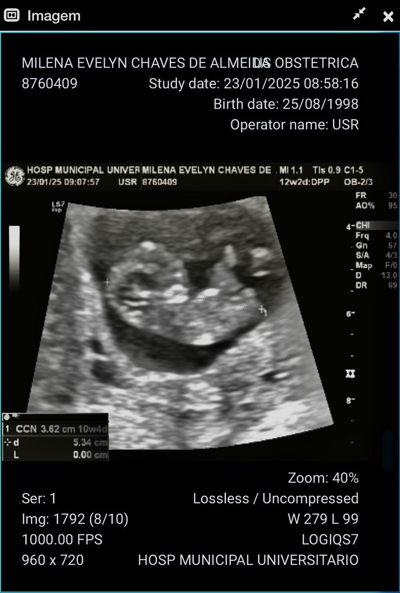 TO GRÁVIDA 
Vem ai mais um(a) sonzer pro time 🩷💙