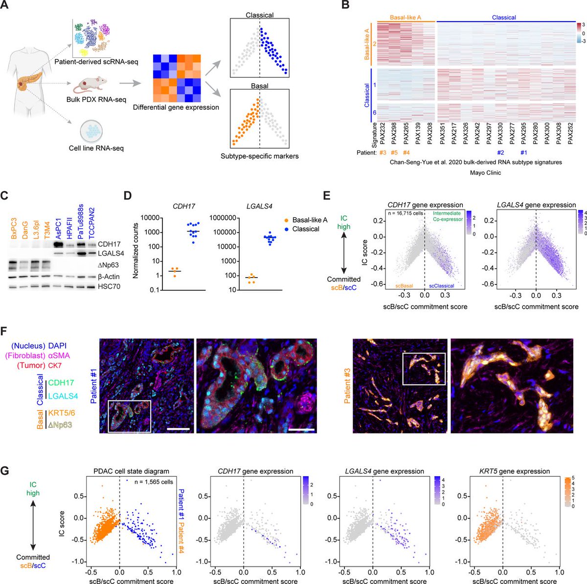 Gut_BMJ's tweet image. #GUTOnline paper by Ekstrom et al on 

"Glucocorticoid receptor suppresses GATA6-mediated RNA polymerase II pause release to modulate classical subtype identity in pancreatic cancer" via

bit.ly/3Q1wUzF

@3amrogram @ProfJohnsen #PancreaticCancer