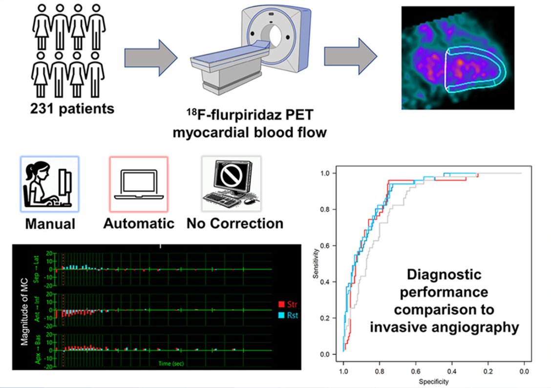 Journal of Nuclear Cardiology (@jncjournal) on Twitter photo Automatic motion correction for myocardial blood flow estimation via 18F-flurpiridaz PET-MPI can be performed rapidly with results comparable to manual motion correction. <a href="/Piotr_JSlomka/">Piotr Slomka PhD</a> <a href="/CedarsSinai/">Cedars-Sinai</a>
Read nowđź”—bit.ly/4hNaa2r Automatic motion correction for myocardial blood flow estimation via 18F-flurpiridaz PET-MPI can be performed rapidly with results comparable to manual motion correction. <a href="/Piotr_JSlomka/">Piotr Slomka PhD</a> <a href="/CedarsSinai/">Cedars-Sinai</a>
Read nowđź”—bit.ly/4hNaa2r
