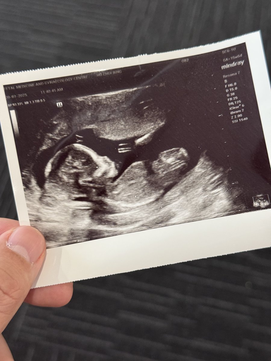 aguyong.eth 🍌 tweet media