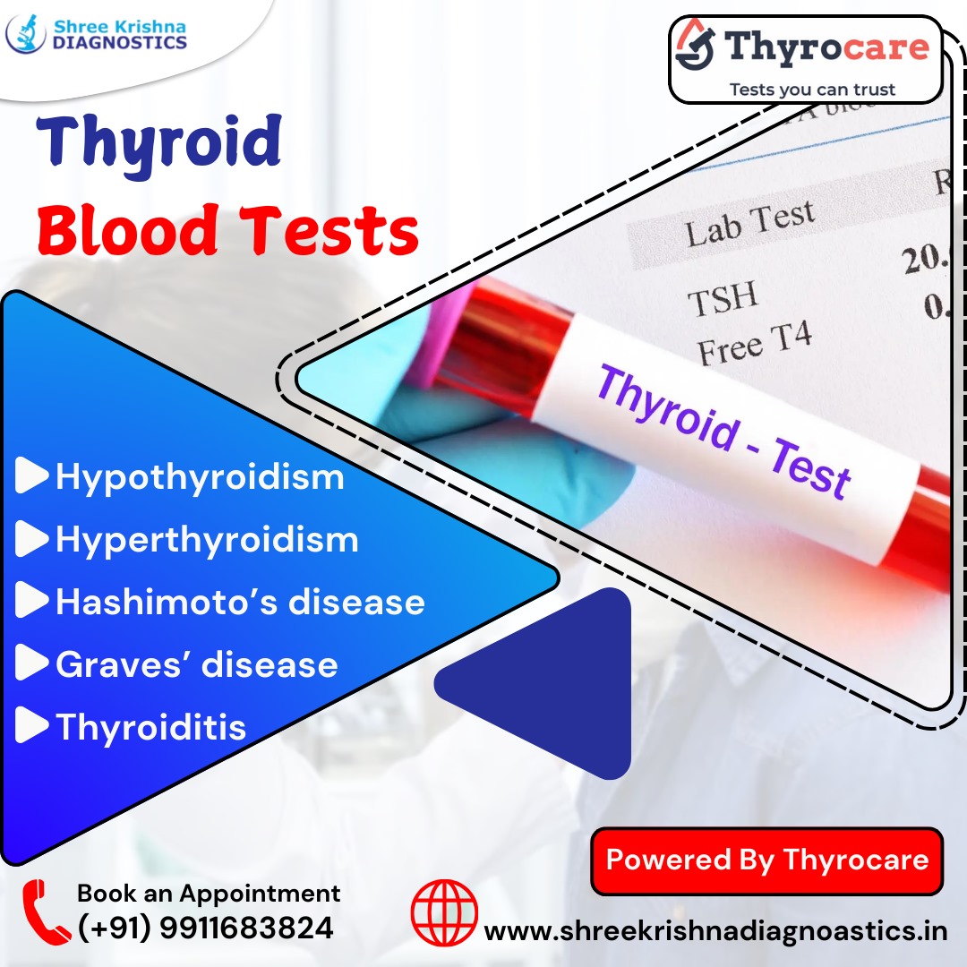 Shree Krishna Diagnostic-Thyrocare Lab tweet media