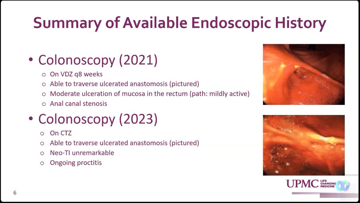 drRobinDud's tweet photo. βοΈNext importan cases during #IBDlive with Prof. @MRegueiroMD & IBD spescialists from πΊπΈ
ποΈWhen the Plans Unexpectedly Change - πΏAll Hands On Deck
Team β½οΈππβΎοΈapproach for best #IBDpatients π₯
ππ₯care
Sometimes surgery is necessary π£in further biology & nutritional treat..