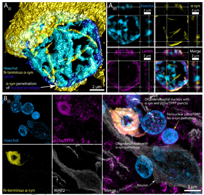The Science of Parkinson's tweet media