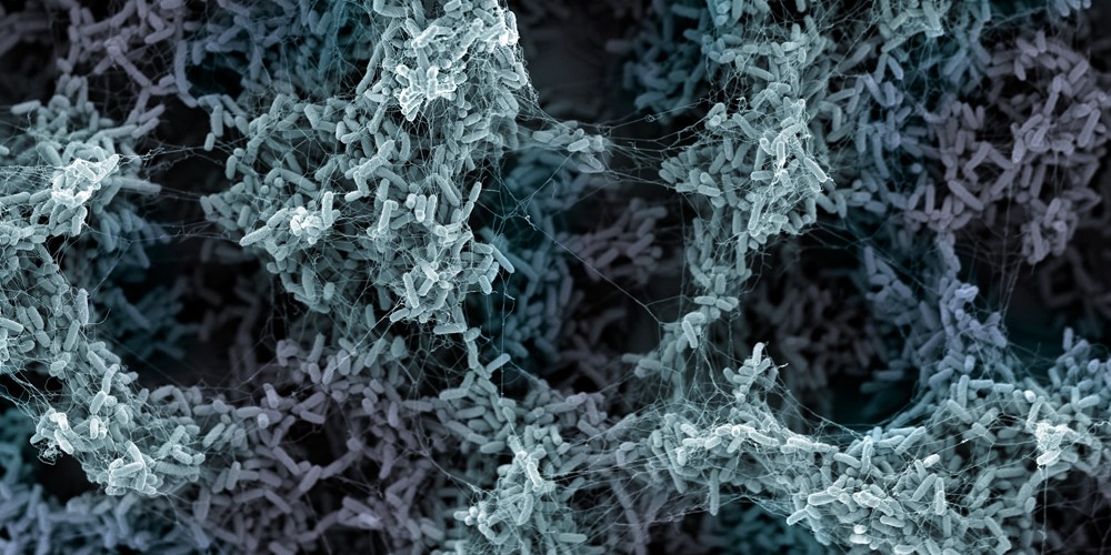 NCCR AntiResist (@nccr_antiresist) on Twitter photo 📢📜Papers from our people!
Rentsch Lab <a href="/NCCR_AntiResist/">NCCR AntiResist</a> 👉onlinelibrary.wiley.com/doi/10.1002/hl…
Out today <a href="/Nature/">nature</a> from <a href="/BumannLab/">BumannLab</a> 👉nature.com/articles/s4158…
In <a href="/NatureBiotech/">Nature Biotechnology</a> from <a href="/ZampieriLab/">Zampieri Lab</a> 👉 nature.com/articles/s4158…
In <a href="/NatureMicrobiol/">Nature Microbiology</a> from <a href="/knutdrescher/">Knut Drescher</a> Lab 👉nature.com/articles/s4156… 📢📜Papers from our people!
Rentsch Lab <a href="/NCCR_AntiResist/">NCCR AntiResist</a> 👉onlinelibrary.wiley.com/doi/10.1002/hl…
Out today <a href="/Nature/">nature</a> from <a href="/BumannLab/">BumannLab</a> 👉nature.com/articles/s4158…
In <a href="/NatureBiotech/">Nature Biotechnology</a> from <a href="/ZampieriLab/">Zampieri Lab</a> 👉 nature.com/articles/s4158…
In <a href="/NatureMicrobiol/">Nature Microbiology</a> from <a href="/knutdrescher/">Knut Drescher</a> Lab 👉nature.com/articles/s4156…