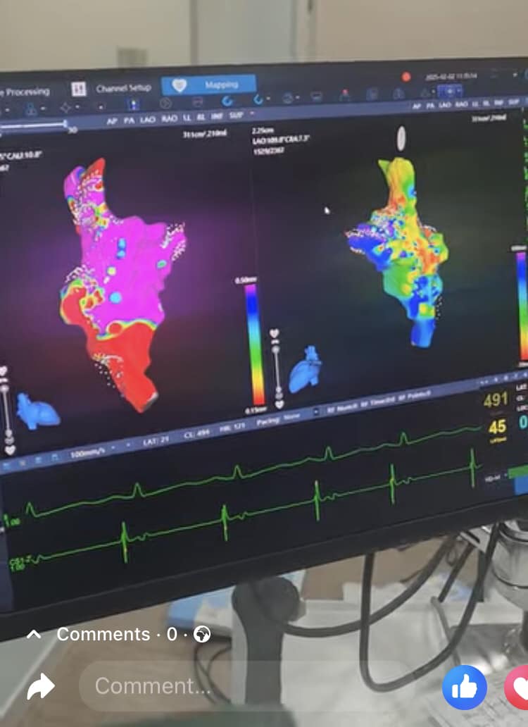 AsimFesc's tweet photo. By the beginning of the year, honored to work with Dr. Noor Sawan @noor_sawan94752  in the first workshop of catheter ablation guided by 3D mapping in Free Syria, Damascus 2025 https://t.co/HxFmkf0lGk