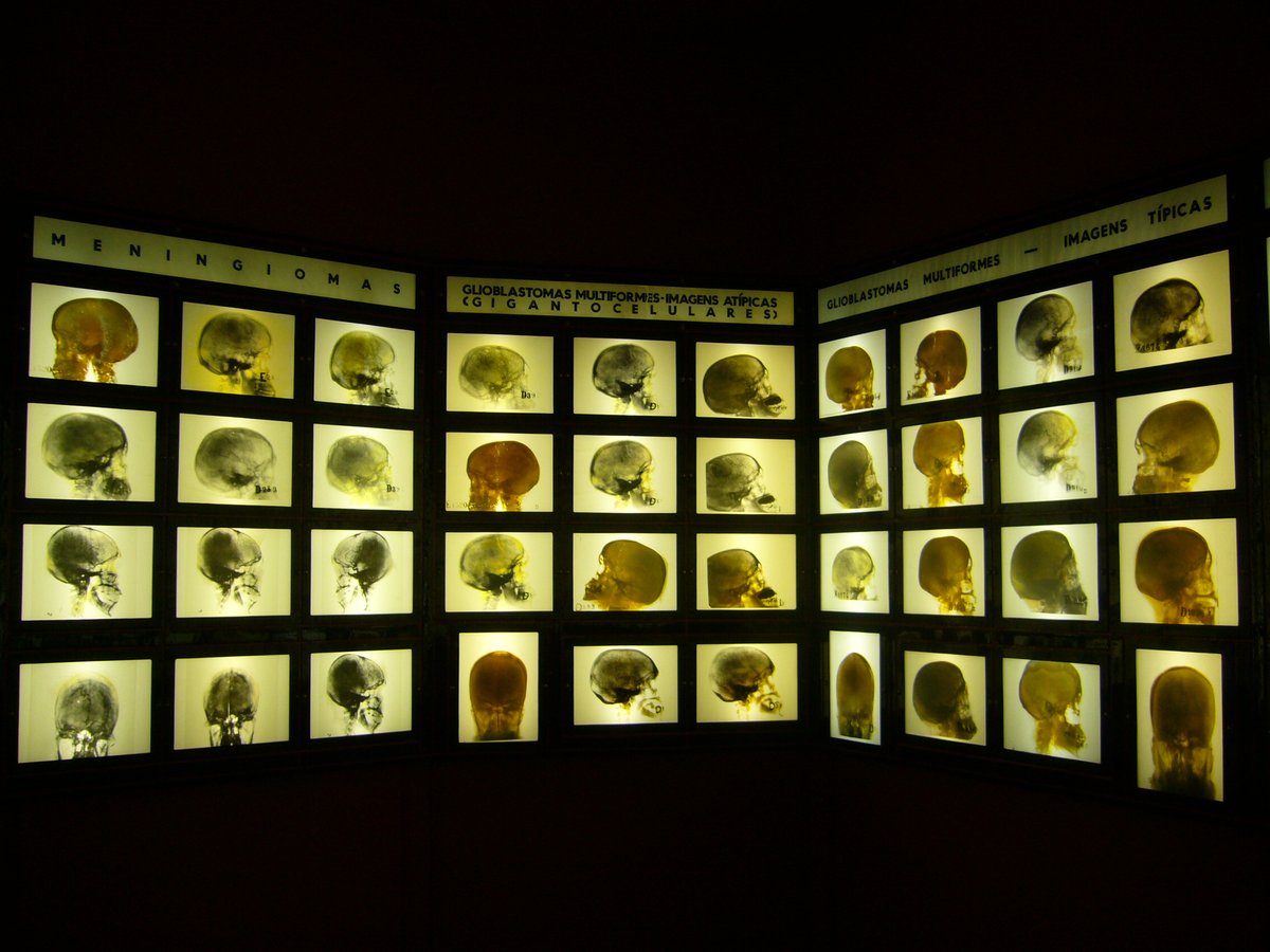 Sabias que... 🔎
Na Faculdade de Medicina ULisboa existe um Museu dedicado a Egas Moniz, o primeiro Nobel português?

O núcleo expositivo mantém a sua museografia e cenografia originais onde se encontram expostos com 400 objetos de diferentes tipologias.

#ULisboa #FMUL