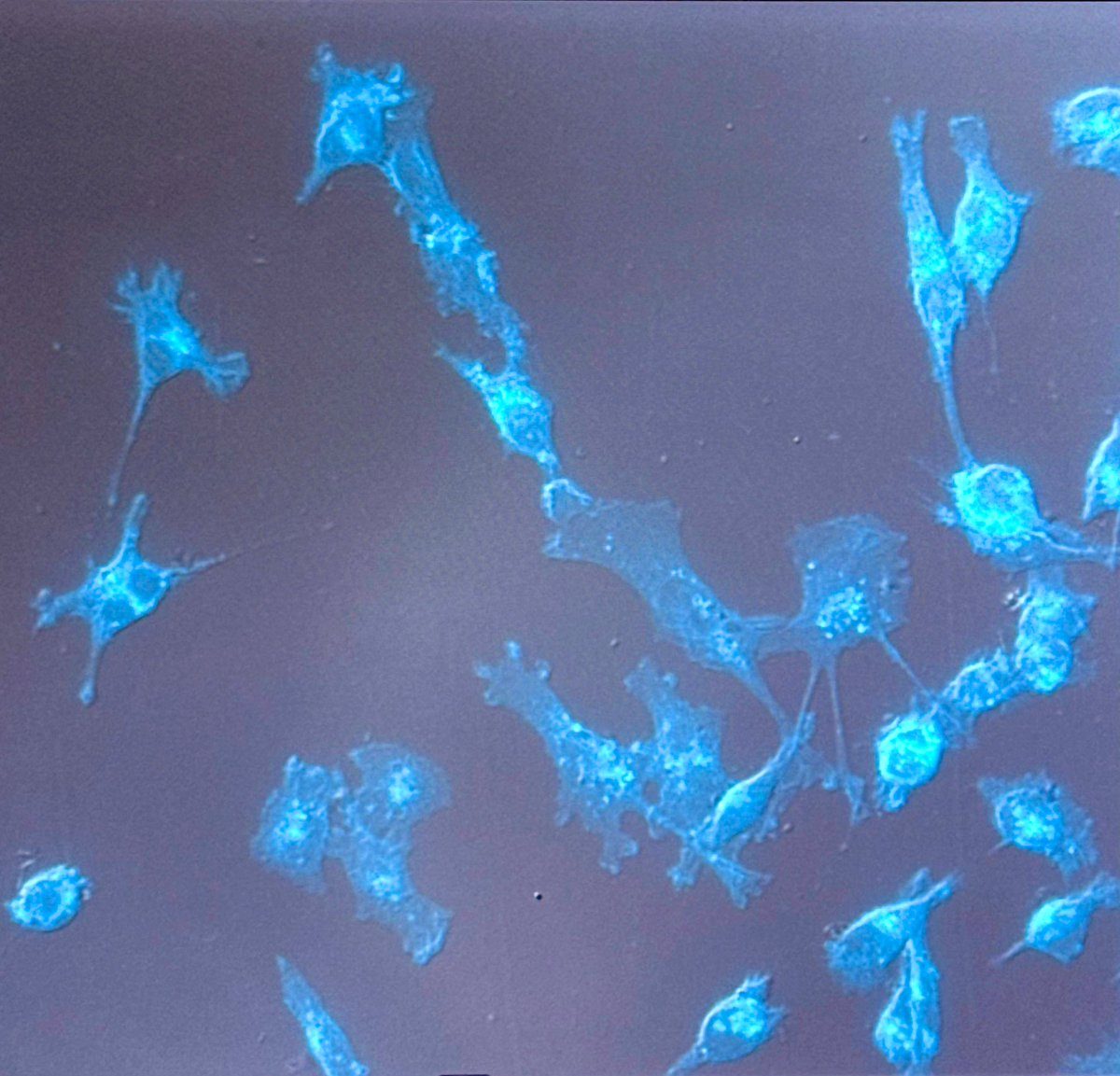 Antonio Benedetto (@anto__benedetto) on Twitter photo It is still Christmas in my NanoBioPhysics Lab as a cutting-edge <a href="/HamamatsuPhoton/">Hamamatsu</a> #ORCA camera got installed on our <a href="/zeiss_micro/">ZEISS Microscopy</a> #AxioObserver7 fluo microscope hosting our <a href="/NanosurfAFM/">Nanosurf</a> #DriveAFM & <a href="/cytosurge/">Cytosurge AG</a> #FluidFM. <a href="/UCD_physics/">UCD Physics</a> <a href="/UCD_Conway/">UCD Conway Institute</a> <a href="/ucdscience/">UCD Science</a> <a href="/UCD_Research/">UCD Research</a> <a href="/ucddublin/">University College Dublin</a> It is still Christmas in my NanoBioPhysics Lab as a cutting-edge <a href="/HamamatsuPhoton/">Hamamatsu</a> #ORCA camera got installed on our <a href="/zeiss_micro/">ZEISS Microscopy</a> #AxioObserver7 fluo microscope hosting our <a href="/NanosurfAFM/">Nanosurf</a> #DriveAFM & <a href="/cytosurge/">Cytosurge AG</a> #FluidFM. <a href="/UCD_physics/">UCD Physics</a> <a href="/UCD_Conway/">UCD Conway Institute</a> <a href="/ucdscience/">UCD Science</a> <a href="/UCD_Research/">UCD Research</a> <a href="/ucddublin/">University College Dublin</a>
