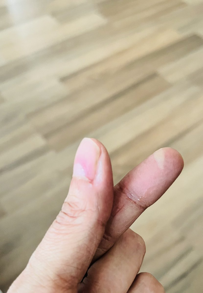 Apoorva_Nath's tweet photo. As if my fingerprint wasn’t already problematic. 🔥 burn. https://t.co/gjAmJSFiJr