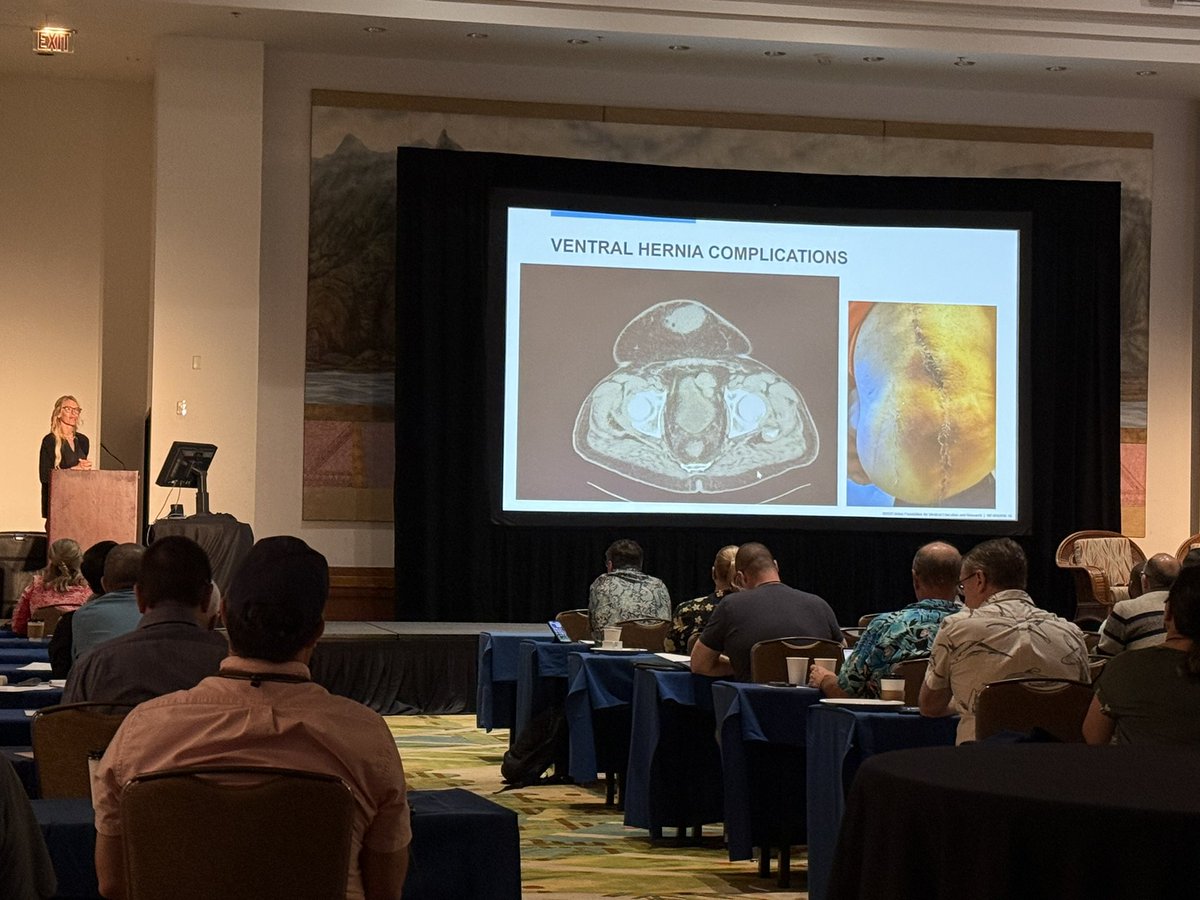 Amit Merchea (@merchea_md) on Twitter photo #hernia day <a href="/MayoClinic/">Mayo Clinic</a> Surgery Symposium. <a href="/herniabarbie/">herniabarbie</a> helping folks deal with complications of hernia repair. #MayoISS25. #hernia day <a href="/MayoClinic/">Mayo Clinic</a> Surgery Symposium. <a href="/herniabarbie/">herniabarbie</a> helping folks deal with complications of hernia repair. #MayoISS25.