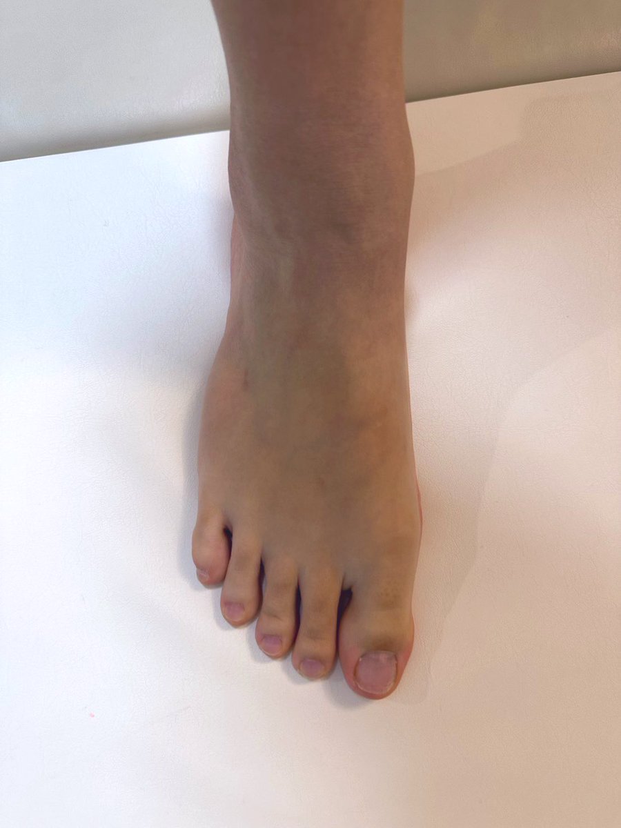 足裏の撮り方忘れちゃった😯
どんな角度で撮ったらいいの？🤔