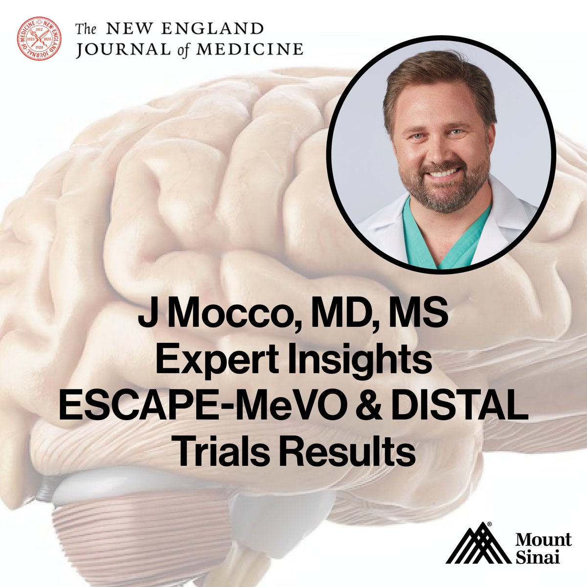 🚨 <a href="/JMoccoMD/">J Mocco, MD, MS</a> discusses the ESCAPE-MeVO &amp; DISTAL trials in <a href="/NEJM/">NEJM</a>, revealing #thrombectomy showed no added benefits for smaller strokes. He highlights the need for tailored stroke treatments &amp; further research to improve outcomes for ischemic strokes. 🧠 #ISC25